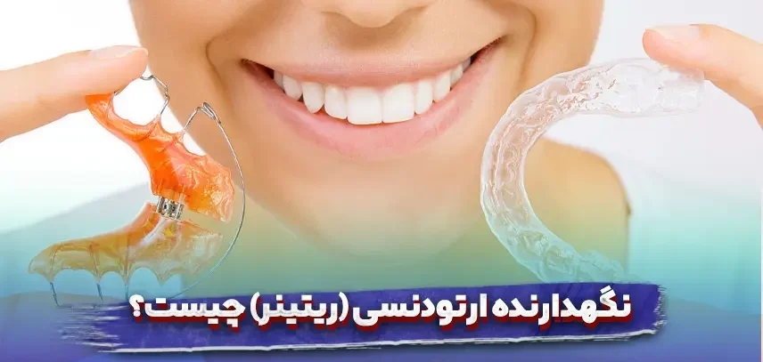 نگهدارنده ارتودنسی چیست و چه انواعی دارد؟