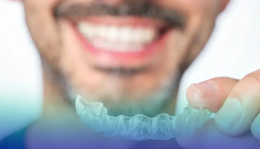 چرا باید از نگهدارنده بعد از ارتودنسی استفاده کنیم؟