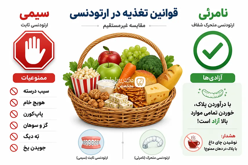 شرایط تغذیه ارتودنسی نامرئی و ارتودنسی ثابت