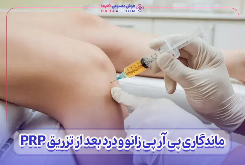 ماندگاری پی آر پی زانو
