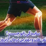 بهترین درمان آرتروز زانو