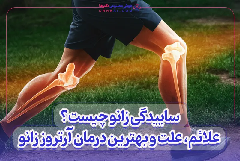 بهترین درمان آرتروز زانو