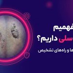 از کجا بفهمیم زگیل تناسلی داریم