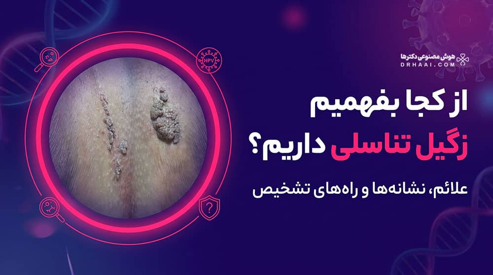 از کجا بفهمیم زگیل تناسلی داریم