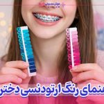 رنگ ارتودنسی دخترانه