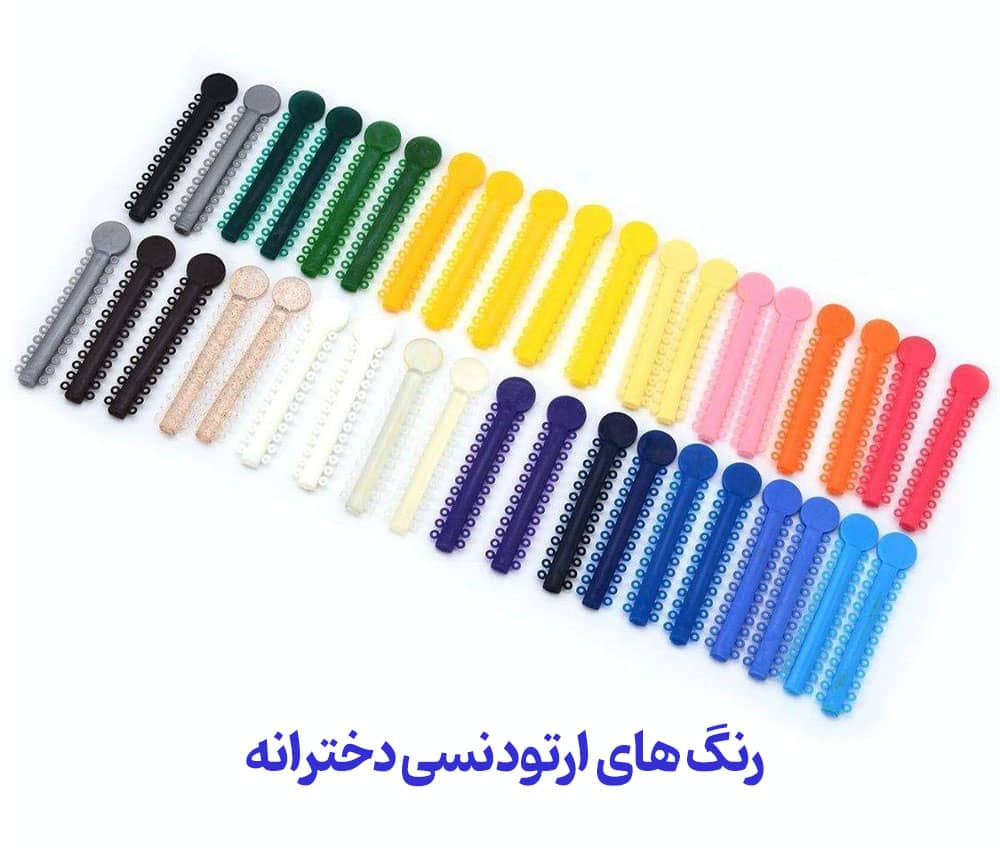 طیف رنگ‌های ارتودنسی شامل یاسی صورتی آبی و سبز نعنایی