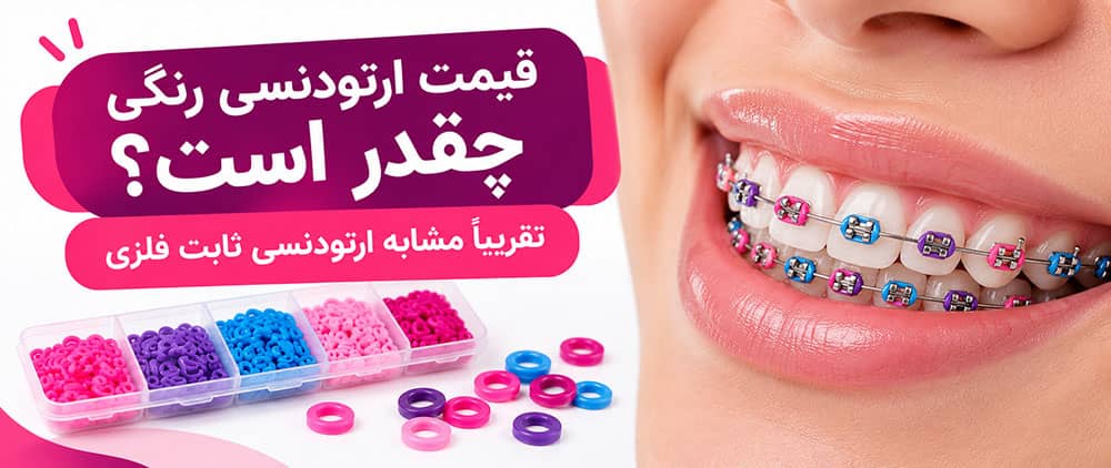 قیمت ارتودنسی رنگی
